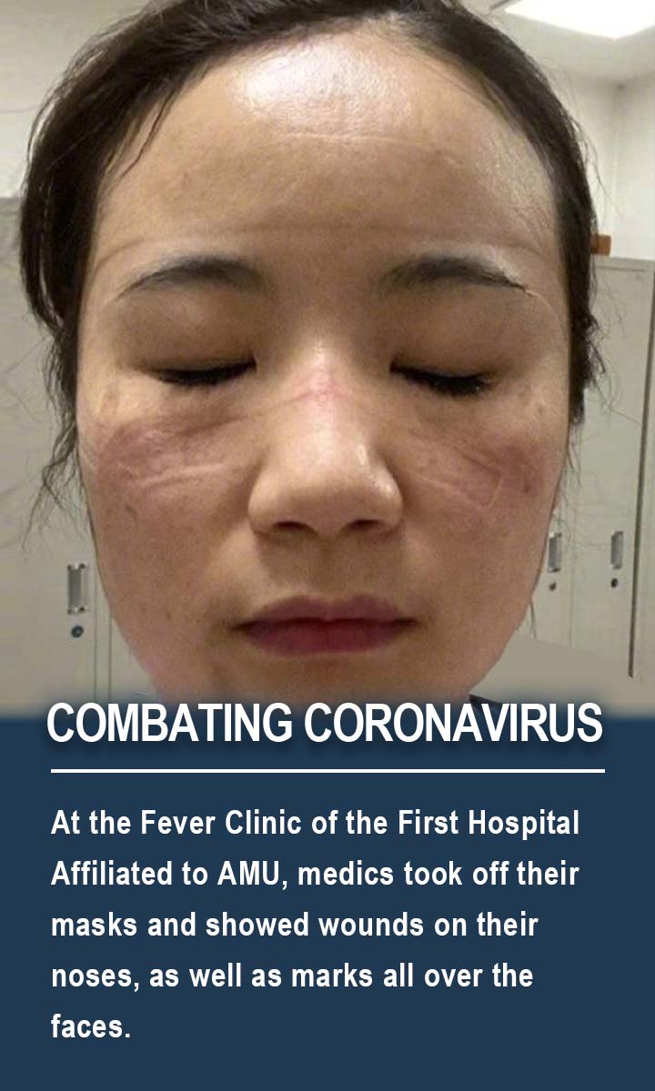 At the Fever Clinic of the First Hospital Affiliated to AMU, medics took off their masks and showed wounds on their noses, as well as marks all over the faces.