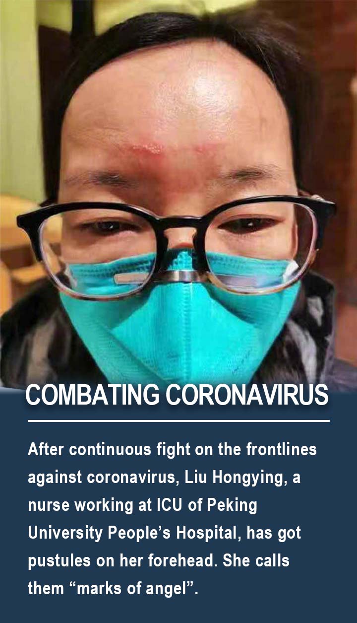 After continuous fight on the frontlines against coronavirus, Liu Hongying, a nurse working at ICU of Peking University People&rsquo;s Hospital, has got pustules on her forehead. She calls them &ldquo;marks of angel&rdquo;.