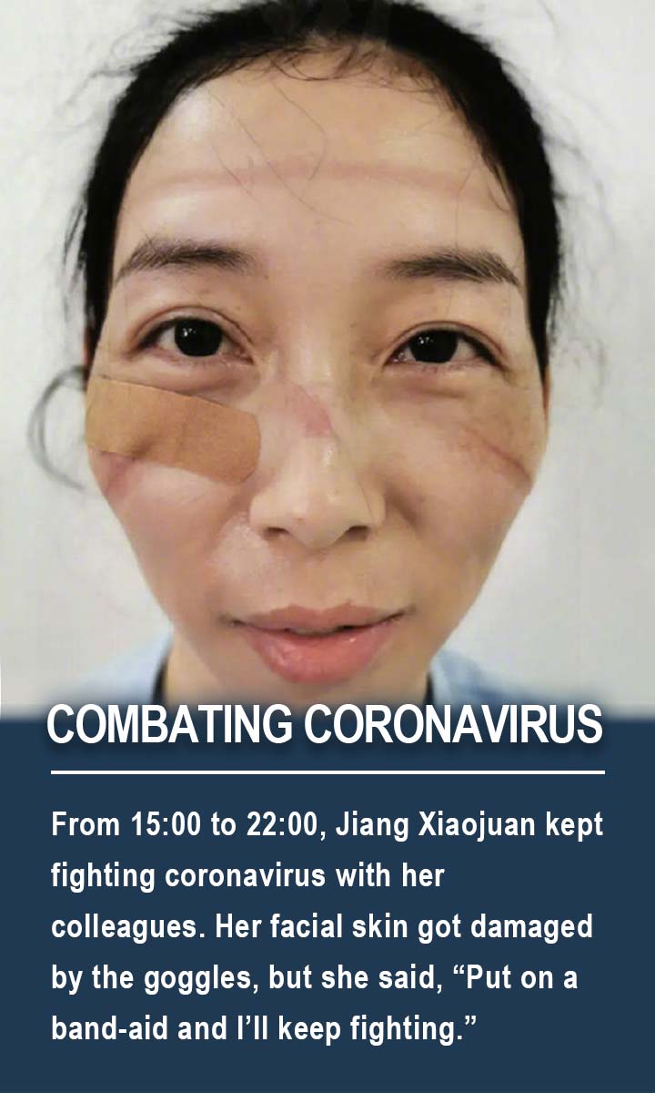 From 15:00 to 22:00, Jiang Xiaojuan kept fighting coronavirus with her colleagues. Her facial skin got damaged by the goggles, but she said, &ldquo;Put on a band-aid and I&rsquo;ll keep fighting.&rdquo;